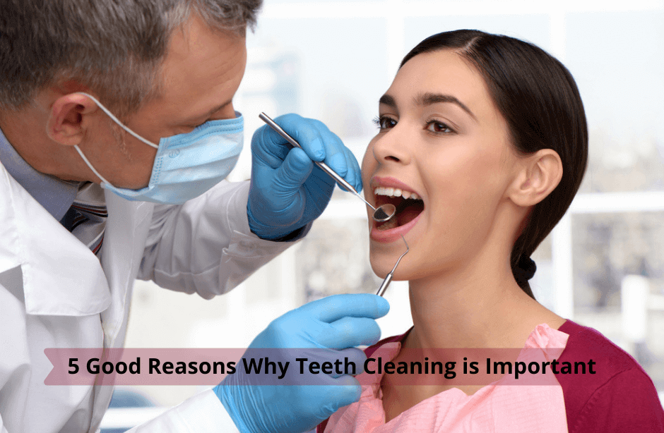 5 Good Reasons Why Teeth Cleaning is Important