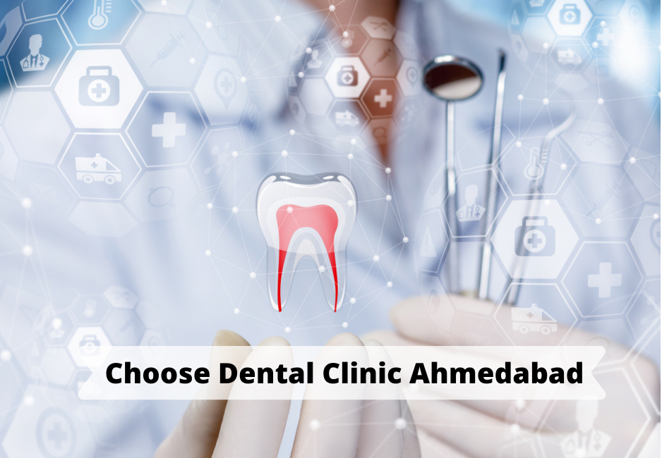 How to Choose the Best Dental Clinic in Ahmedabad?