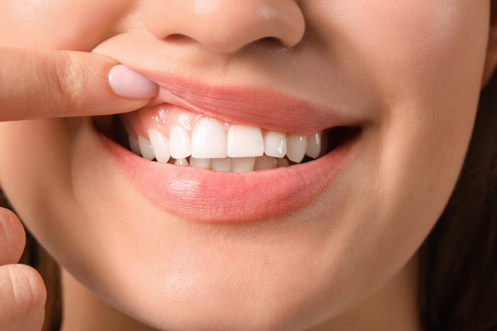 Nurturing Radiant Smiles: The Crucial Role of Teeth Cleaning and Oral Hygiene