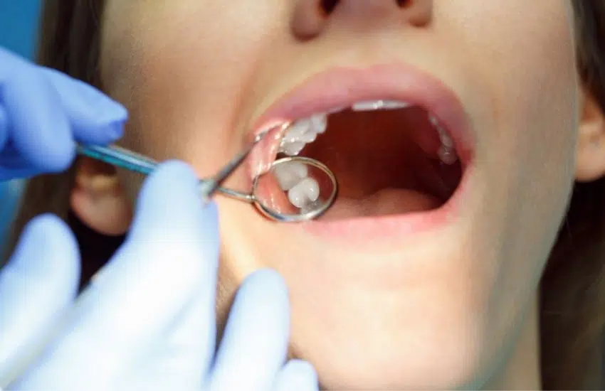 All About Wisdom Teeth: Extraction, Pain, and Recovery